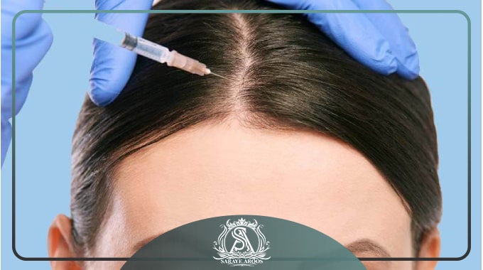 روش های انجام مزوتراپی در بهترین مرکز مزوتراپی شرق تهران