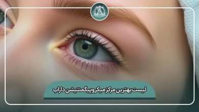 بهترین مرکز میکروپیگمنتیشن ابرو داراب